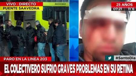 "Ratas" desagradecidas le partieron un chop de cerveza en la cabeza a colectivero