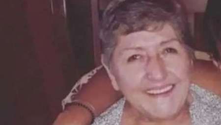 Murió la mujer a la que le amputaron la pierna equivocada