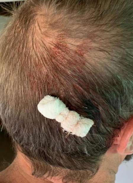 Pegatineros le dieron una golpiza al hermano de Gustavo Sáenz