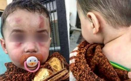 Indignante: Un bebé salteño fue salvajemente golpeado por su mamá