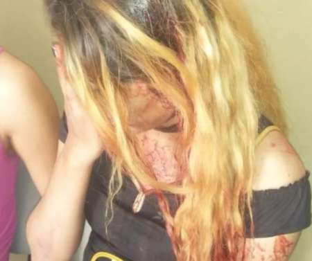 En pleno centro de Salta atacaron brutalmente a dos chicas trans: bronca y reclamo