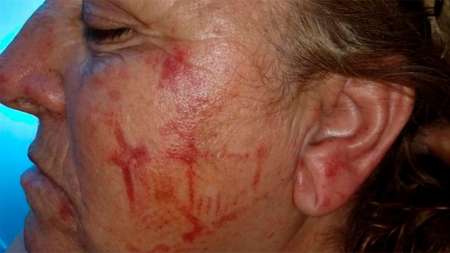 Video: Le marcaron la zapatilla en la cara a golpes durante violento asalto