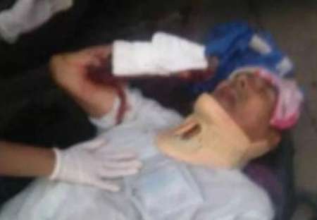 Cayó de un colectivo en movimiento y terminó hospitalizado