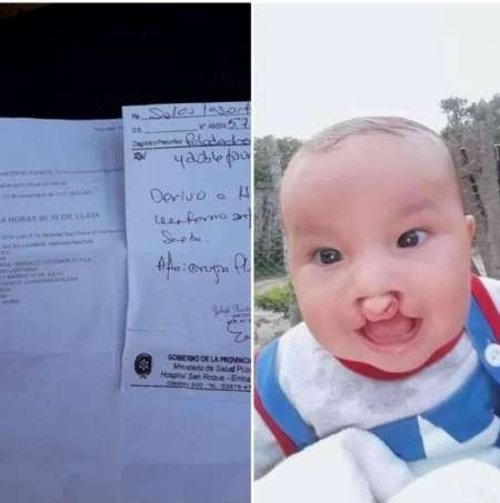 Abraham, el bebé con labio leporino, será operado gratuitamente en Orán