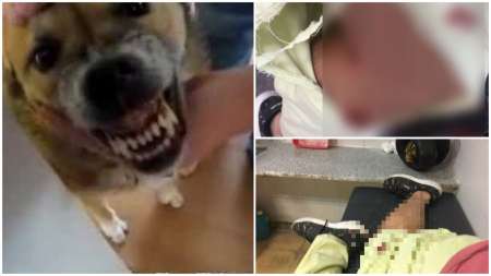 [HAY FOTOS] Perros callejeros le destrozaron la pierna a un salteño: sucedió en pleno centro