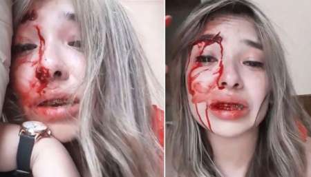 VIDEO Impactante: una joven denunció que su pareja la golpeó brutalmente en Navidad