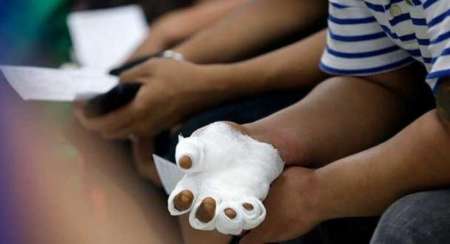 En el Materno hubo un 50% menos de niños quemados por pirotecnia