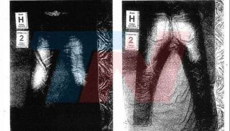 Las fotos de las manos hinchadas de los rugbiers tras la golpiza a Fernando