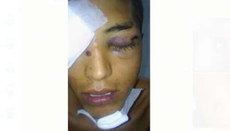 El chango baleado por la Policía perdió un ojo y podría perder el otro: la desesperación de la familia