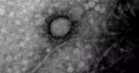 Coronavirus: fotografiaron por primera vez la cepa que circula en Argentina