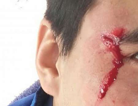 Otra vez, un colectivero víctima de un violento asalto