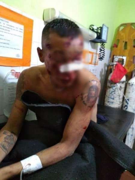 Ballivián: En un confuso hecho un motociclista resultó herido en el rostro y policías lesionados