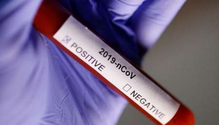 Con 637 nuevos casos, suman 16.851 infectados en el país