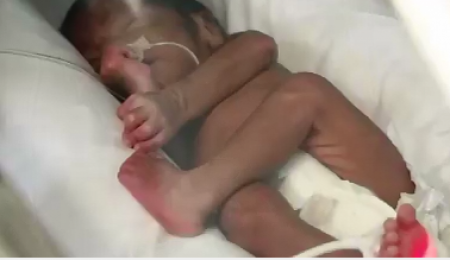 Por la cuarentena, los cuatrillizos del “milagro” aún no pueden conocer a su papá