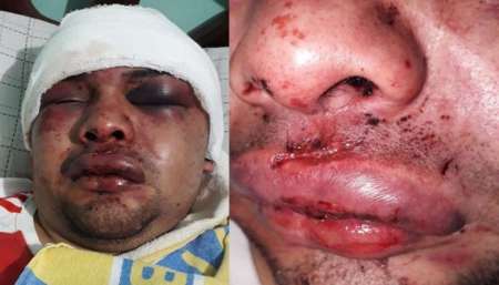 Lo atacaron en manada para robar una moto en el pasaje Saravia