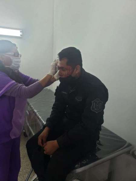 Policías brutalmente agredidos durante un despeje por un campeonato de fútbol