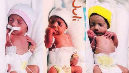 Nacieron las trigemelas, un caso que se da cada 200 millones de embarazos