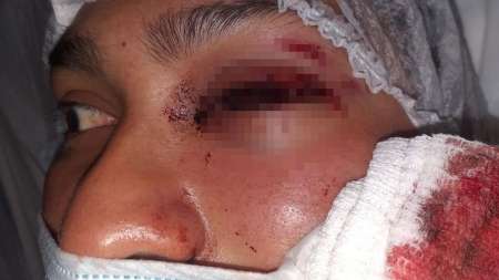 Una bala de goma de la policía de Salta terminó con su carrera para militar