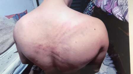 Quisieron meterle una media sucia en la boca, lo golpearon hasta que lloró y tuvo que sonreír a la cámara para evitar más golpes