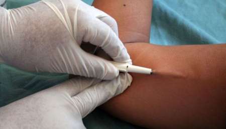 El Ministerio de Salud realiza una campaña de colocación de implantes subdérmicos