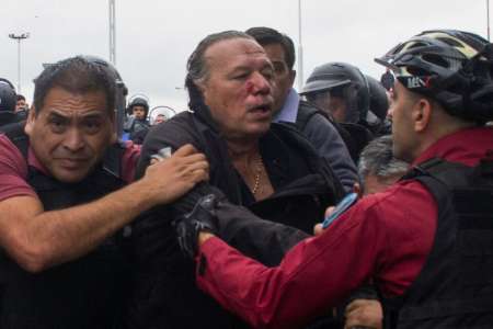 Dieron el parte médico sobre la lesión de Sergio Berni