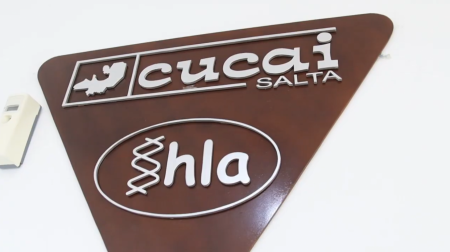Salta fortalece su red de trasplantes con nueva tecnología