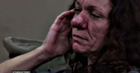 Mujer "Pinocho", desesperada por horrible enfermedad