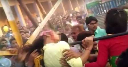 Se sacó selfie y "vuelta al mundo" le arrancó el cuero cabelludo