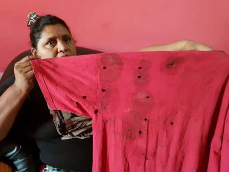 En un confuso episodio policial, un joven fue baleado en Orán