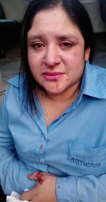 Pasajero demolió a golpes a una mujer chofer del Corredor 7