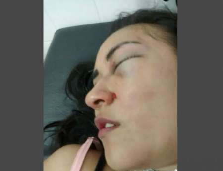 Energúmeno salteño le dio una golpiza a su novia y la desfiguró