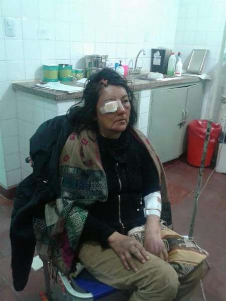 Detuvieron al hombre que atacó a una maestra rural para robarle