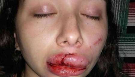 Intentaron violarla entre tres, se resistió y le desfiguraron la cara con un hierro