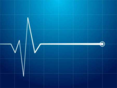 Descubren lo que sucede en el cerebro minutos antes de morir