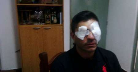 Tiró agua hirviendo a peregrinos y ácido a su vecino: fue trasladado al Ragone