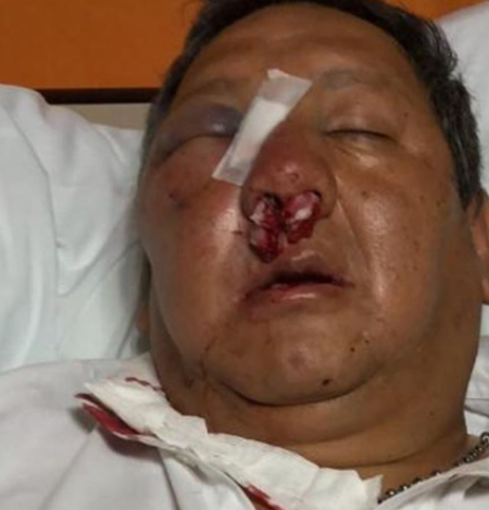 Mirá cómo quedó el inspector agredido por un vendedor ambulante