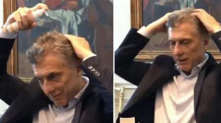 VIDEO: Macri mostró cómo combate su calvicie
