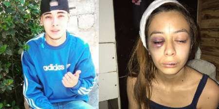 Detuvieron al hombre que atacó a martillazos a su novia