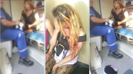 Dos mujeres trans denunciaron que fueron agredidas ferozmente por la policía